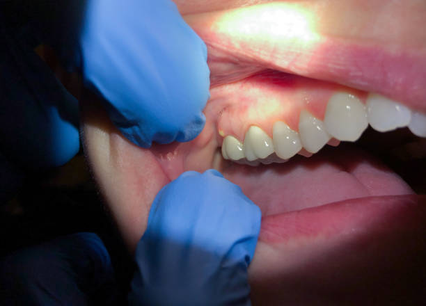 Best 24-Hour Emergency Dentist in New Deal, TX