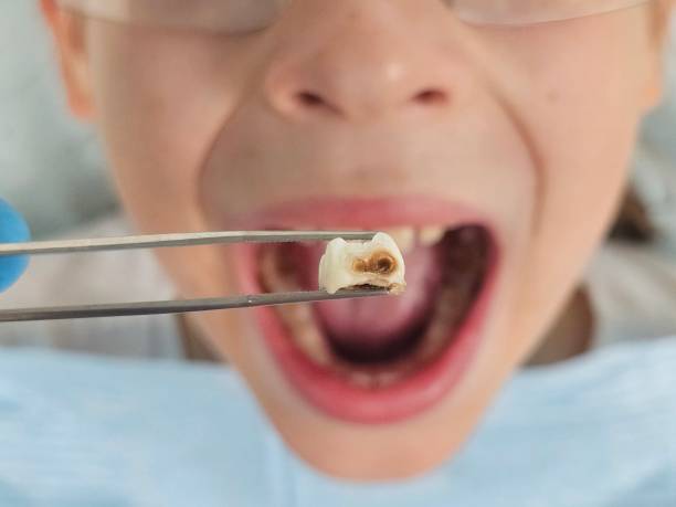 Best Urgent Dental Care in New Deal, TX
